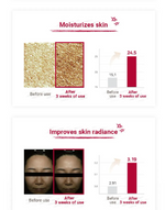 將圖片載入圖庫檢視器 Eclair - LED Therapy Mask | 恢復肌膚 ECLAIR LED 燈療面膜