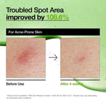 將圖片載入圖庫檢視器 ANUA Azelaic Acid 10 Hyaluron Redness Soothing Serum 169
